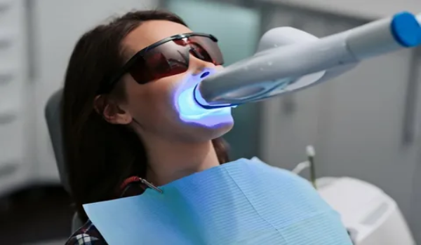 Laser Teeth Whitening (Bleaching)
