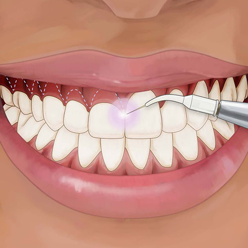 Diş Estetiği Pembe Estetik